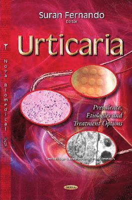 bokomslag Urticaria