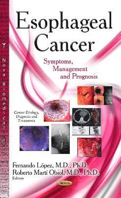 bokomslag Esophageal Cancer