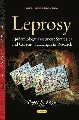bokomslag Leprosy