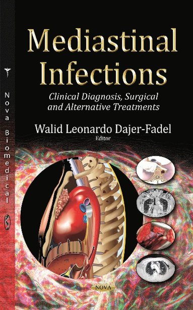 bokomslag Mediastinal Infections