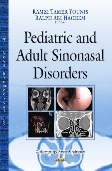 bokomslag Paranasal Sinuses