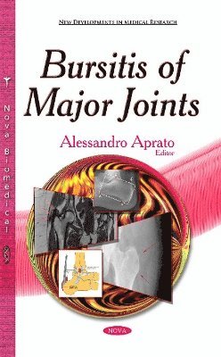 Bursitis of Major Joints 1