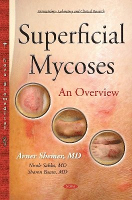 Superficial Mycoses 1