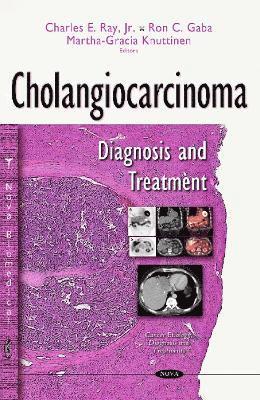 bokomslag Cholangiocarcinoma