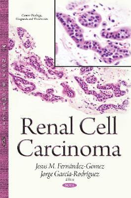 bokomslag Renal Cell Carcinoma