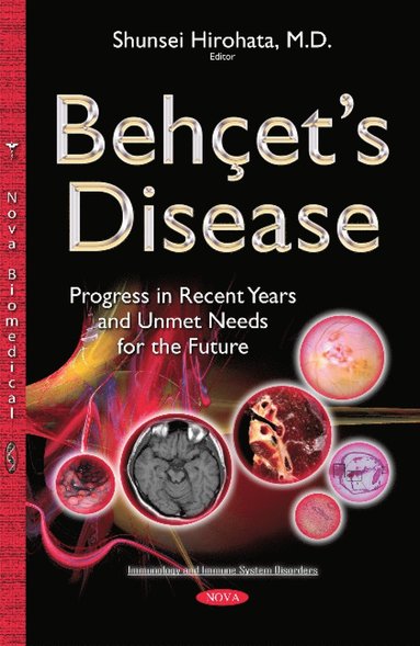 bokomslag Behçets Disease