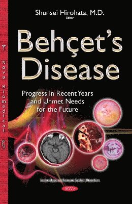 Behets Disease 1