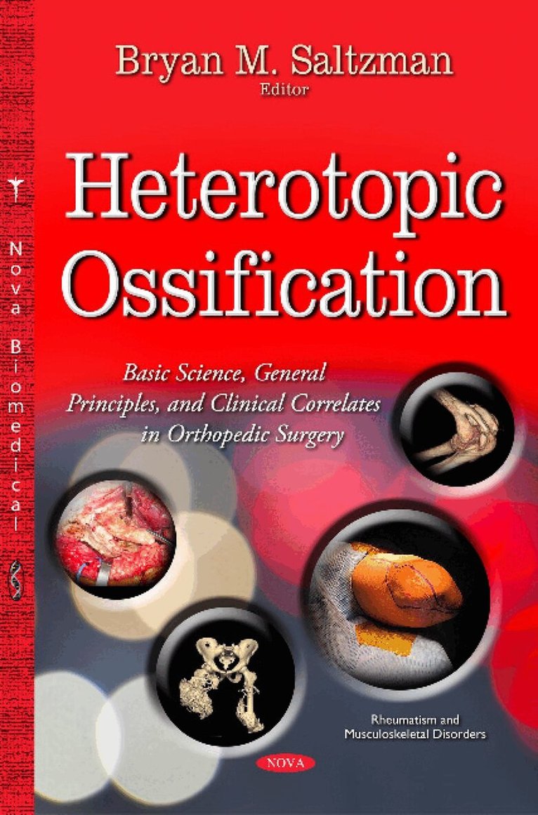 Bryan M Saltzman - Heterotopic Ossification, Inbunden