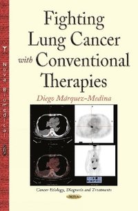 bokomslag Fighting Lung Cancer with Conventional Therapies