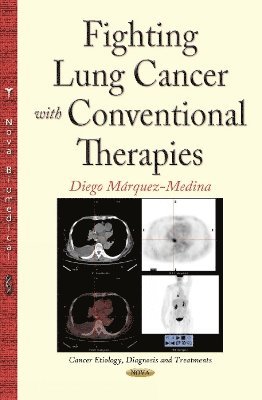 bokomslag Fighting Lung Cancer with Conventional Therapies