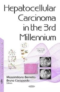 bokomslag Hepatocellular Carcinoma in the 3rd Millennium