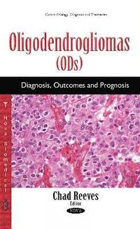 bokomslag Oligodendrogliomas (ODs)