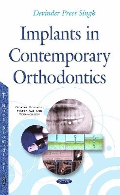 bokomslag Implants in Contemporary Orthodontics