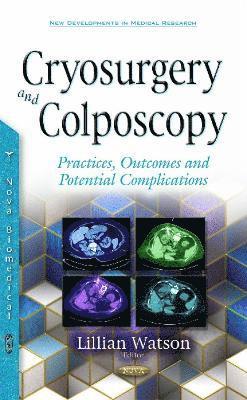 Cryosurgery & Colposcopy 1