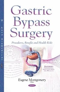 bokomslag Gastric Bypass Surgery