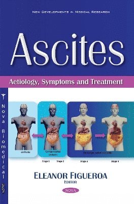 bokomslag Ascites