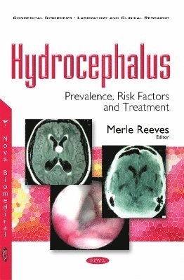 Hydrocephalus 1