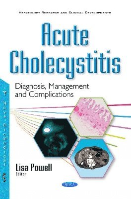 bokomslag Acute Cholecystitis