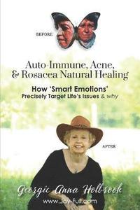 bokomslag Auto-Immune, Acne, & Rosacea Natural Healing - How 'Smart Emotions' Precisely Target Life's Issues & Why