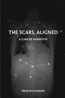 bokomslag Scars, Aligned