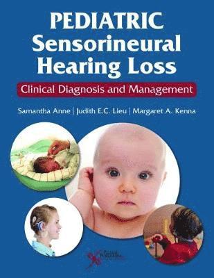 Pediatric Sensorineural Hearing Loss 1
