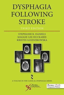 bokomslag Dysphagia Following Stroke