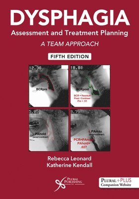 bokomslag Dysphagia Assessment and Treatment Planning