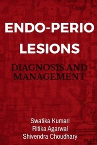 bokomslag Endo-Perio Lesions