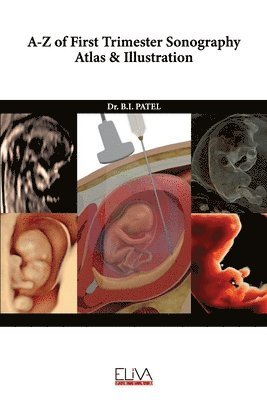 bokomslag A-Z of First Trimester Sonography Atlas & Illustration