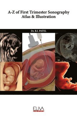 A-Z of First Trimester Sonography Atlas & Illustration 1