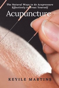 bokomslag Acupuncture