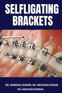 bokomslag Selfligating Brackets