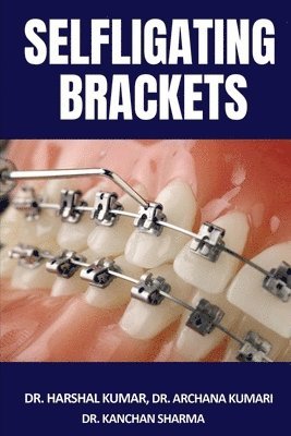 Selfligating Brackets 1