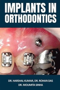 bokomslag Implants in Orthodontics