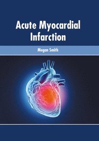 bokomslag Acute Myocardial Infarction