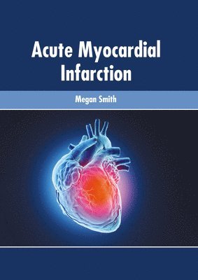 Megan Smith - Acute Myocardial Infarction, Inbunden