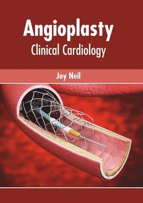 Angioplasty: Clinical Cardiology 1