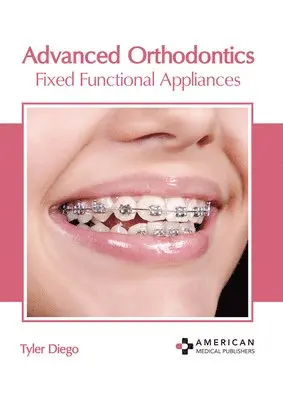 Tyler Diego - Advanced Orthodontics: Fixed Functional Appliances, Inbunden. Tillgänglighet: Lägg i varukorg
