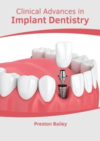 bokomslag Clinical Advances in Implant Dentistry