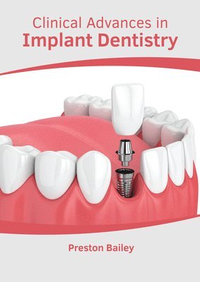 Clinical Advances in Implant Dentistry 1