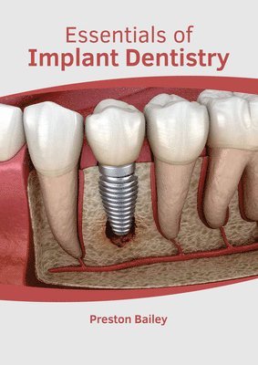 bokomslag Essentials of Implant Dentistry