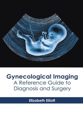 bokomslag Gynecological Imaging: A Reference Guide to Diagnosis and Surgery