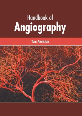 Handbook of Angiography 1