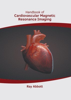 Ray Abbott - Handbook of Cardiovascular Magnetic Resonance Imaging, Inbunden