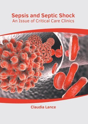 Sepsis and Septic Shock: An Issue of Critical Care Clinics 1