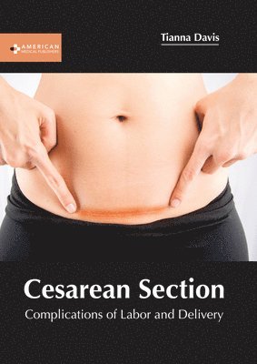 bokomslag Cesarean Section: Complications of Labor and Delivery