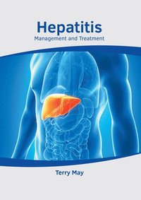 bokomslag Hepatitis: Management and Treatment