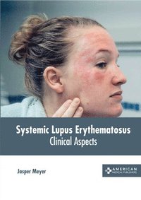 bokomslag Systemic Lupus Erythematosus: Clinical Aspects
