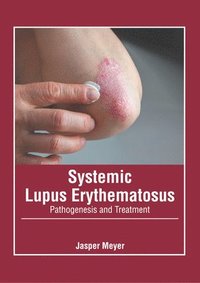 bokomslag Systemic Lupus Erythematosus: Pathogenesis and Treatment