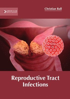 Reproductive Tract Infections 1